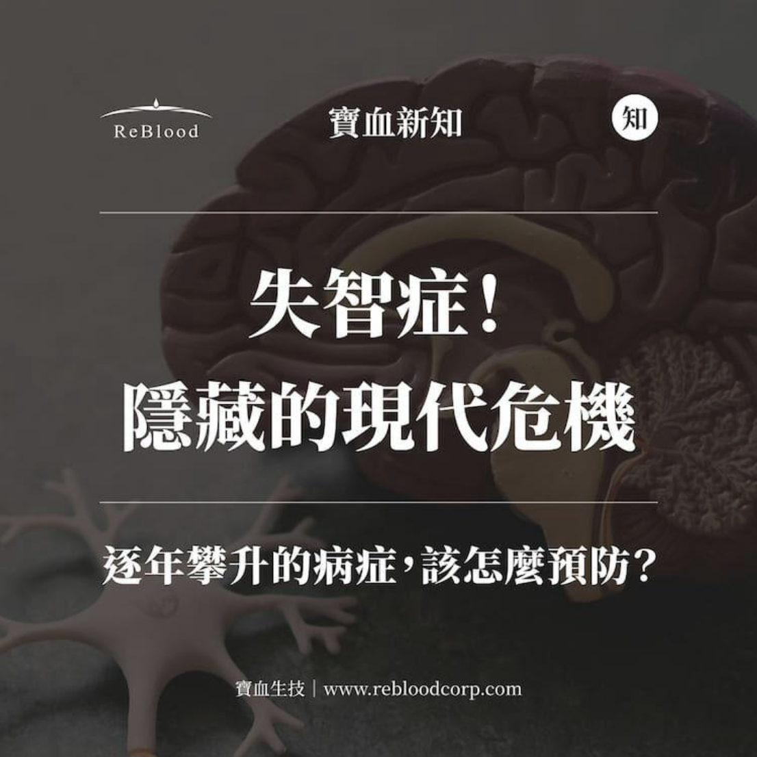 可能罹患失智症的大腦,該如何預防?