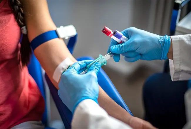 STD & STI Testing Manteca
