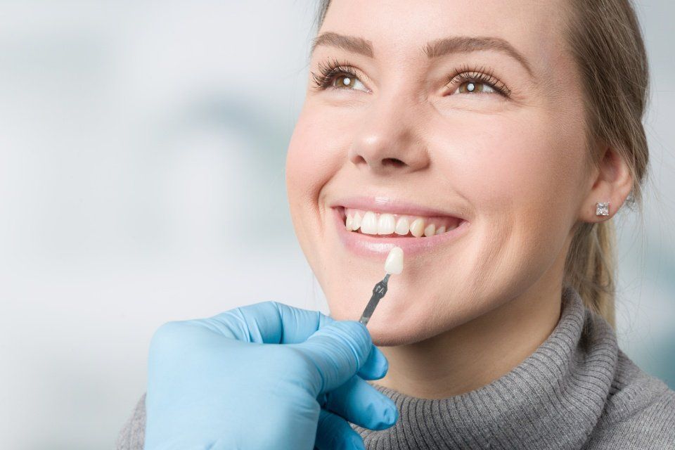 cosa sono le faccette dentali