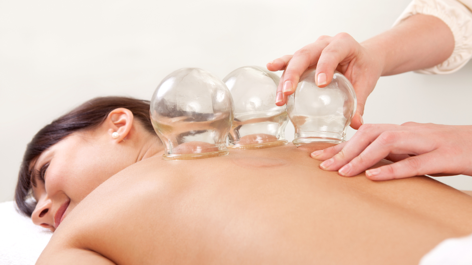A woman is getting a cupping treatment on her back.