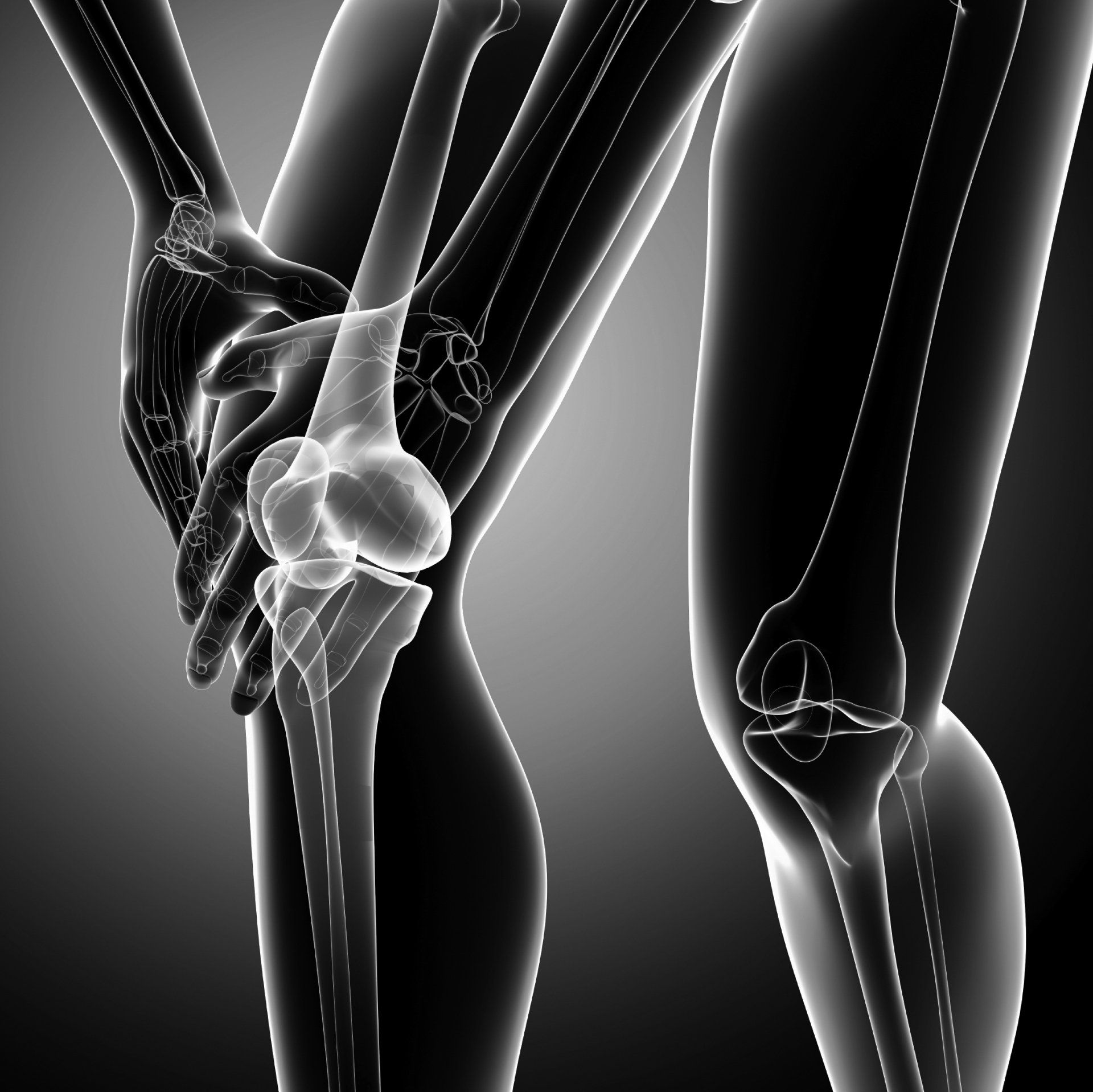 X-ray style view of knee joints with highlighted bones and arthritis pain focus