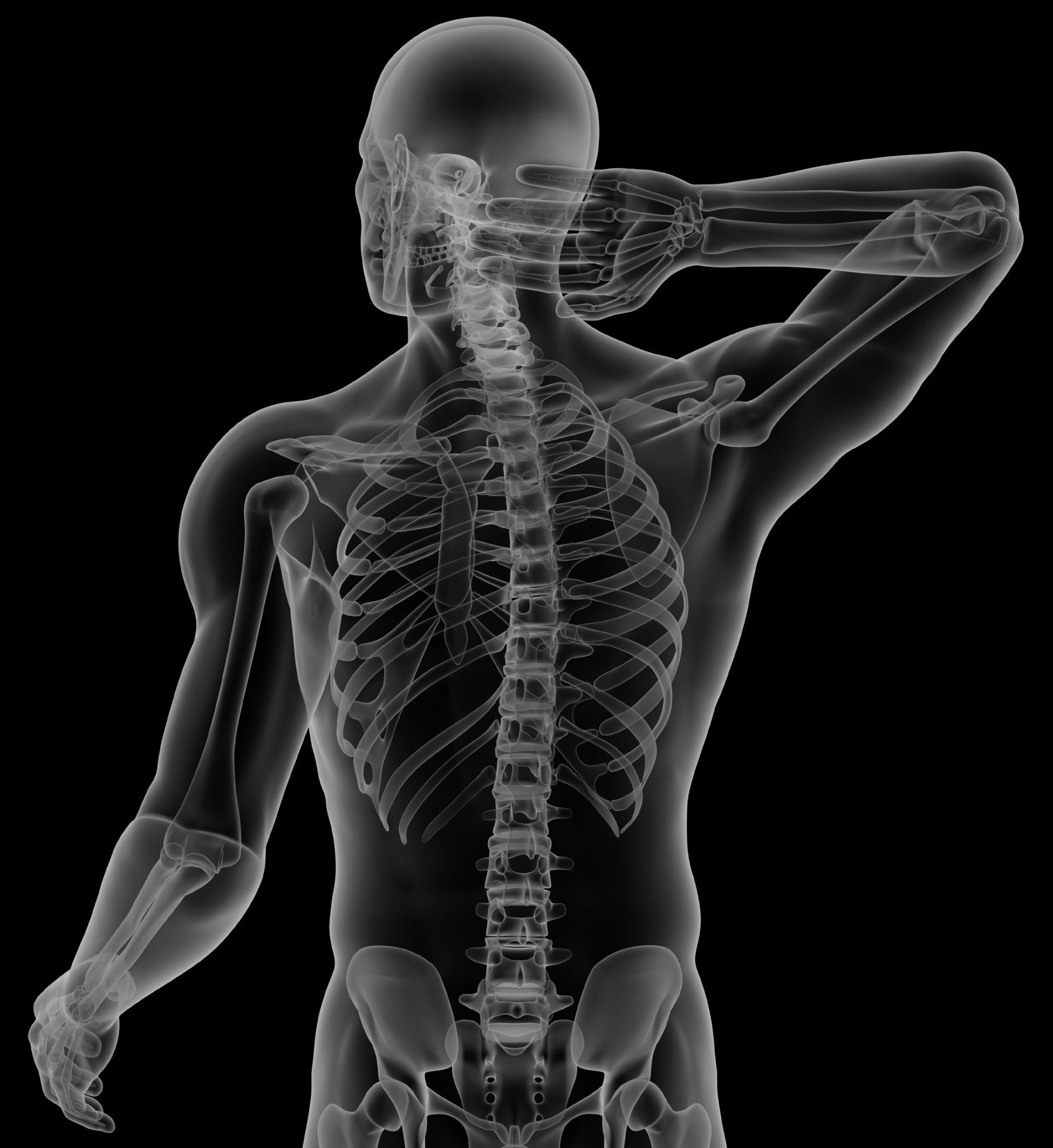 X-ray view of a human skeleton, one arm raised behind the head, showing spine and rib cage
