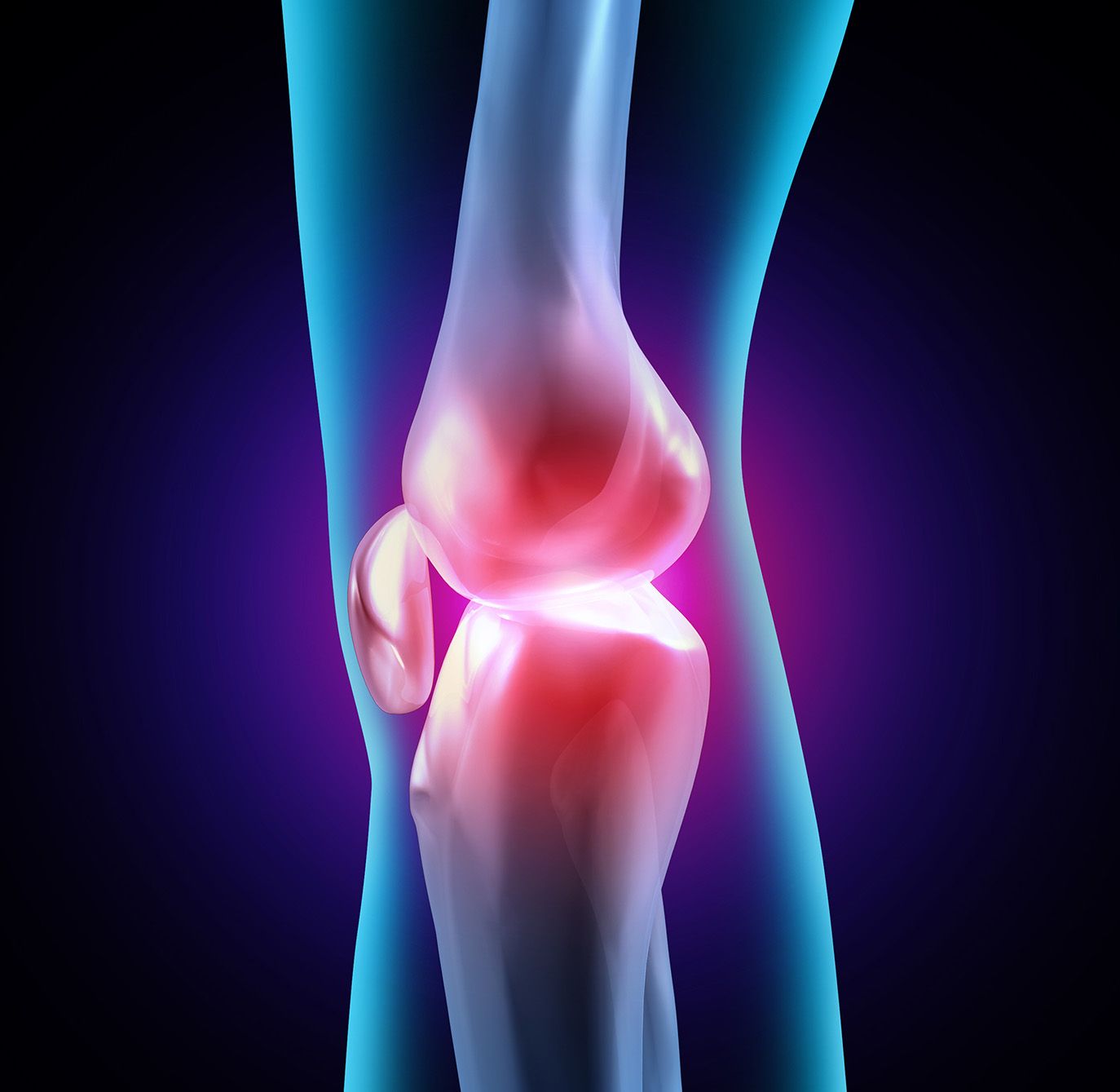 Illustration of a swollen, inflamed knee joint with red pain highlights.