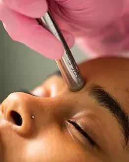 A woman is getting a microdermabrasion treatment on her face
