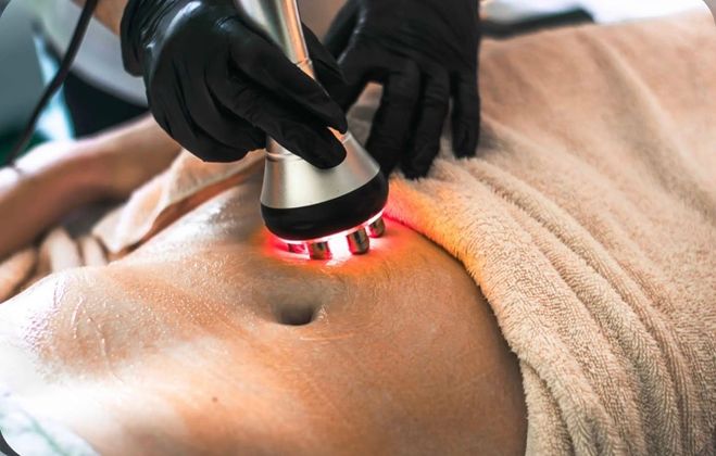 A woman is getting a laser hair removal treatment on her face