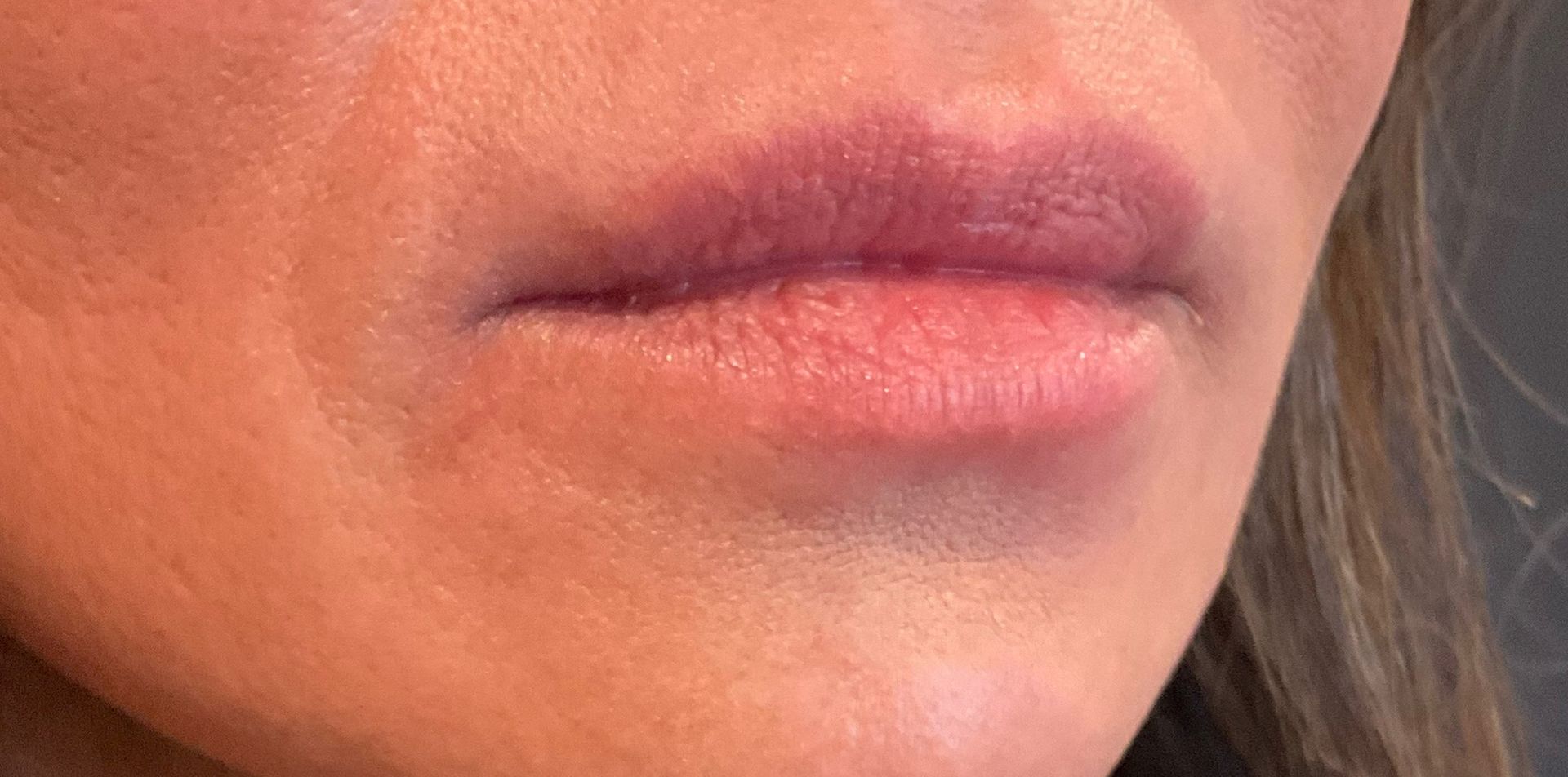 Lips