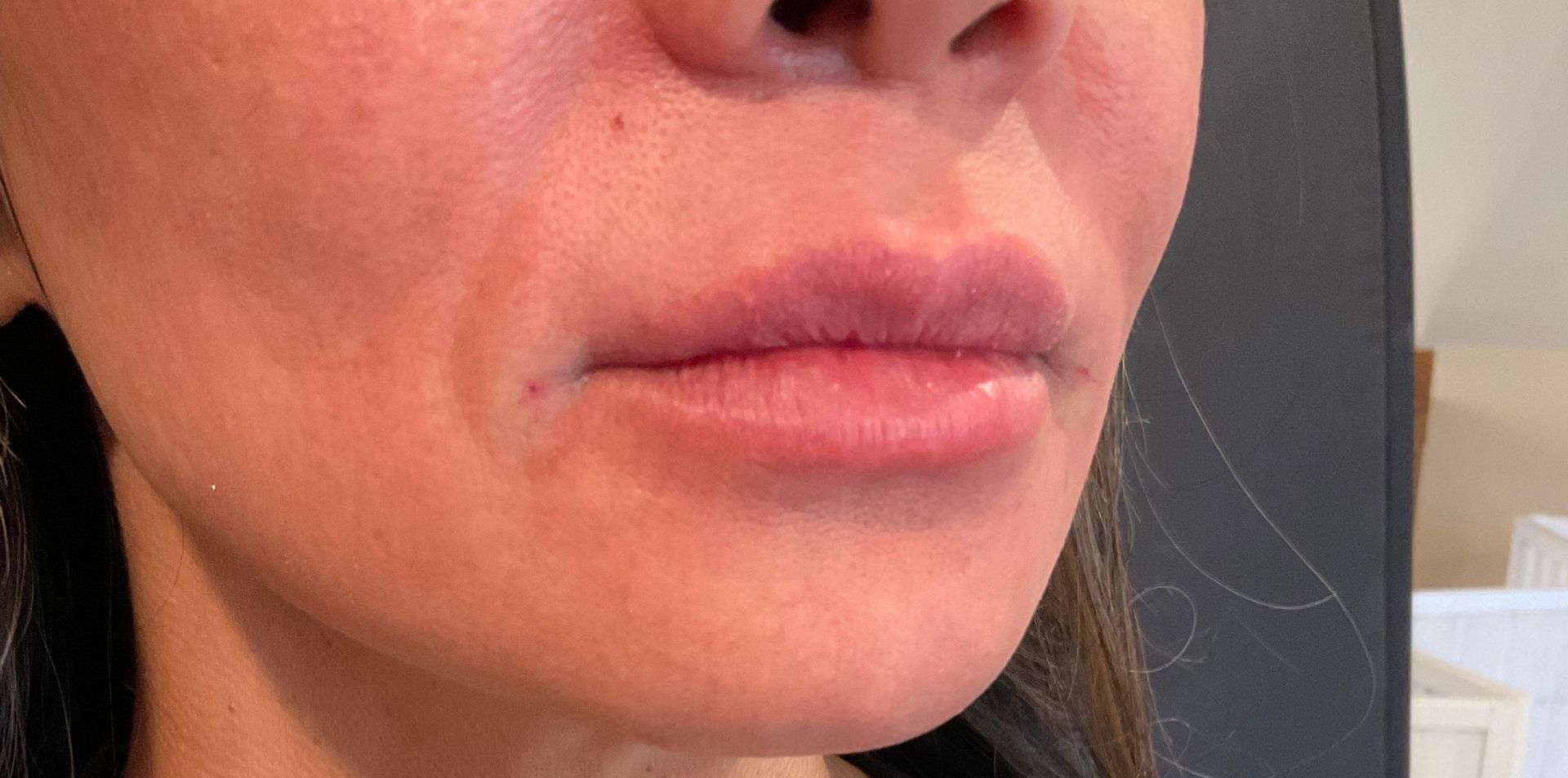 Lips