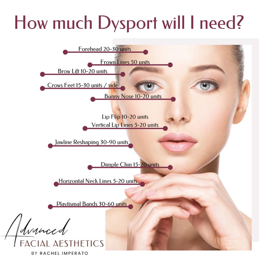 How much Dysport® guide