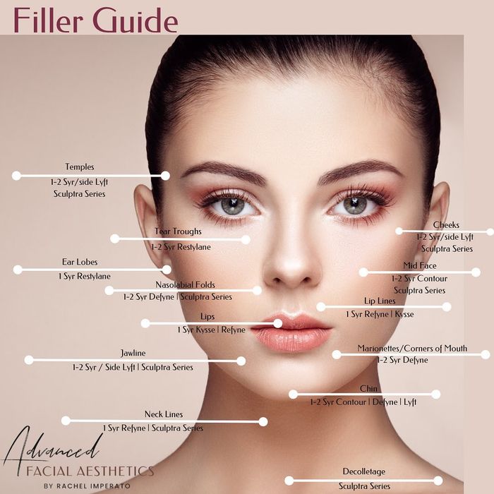 Filler guide