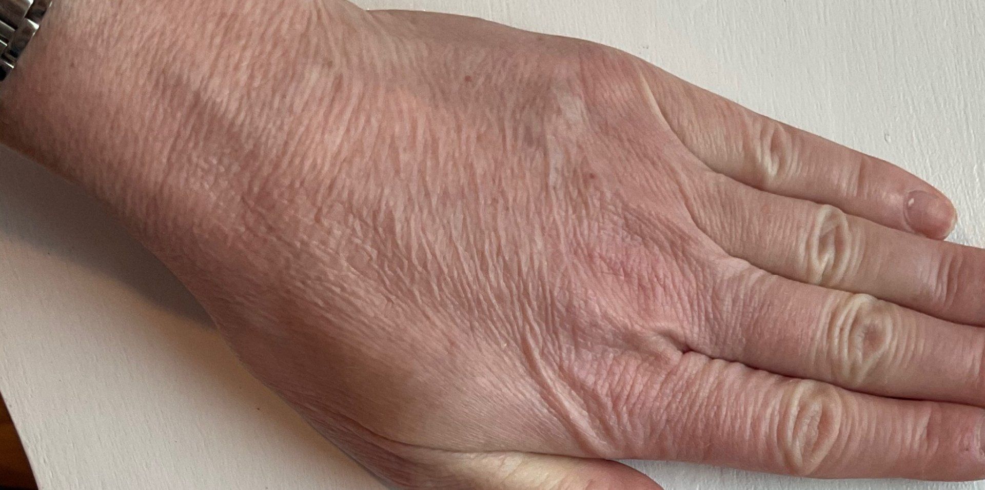 Hands