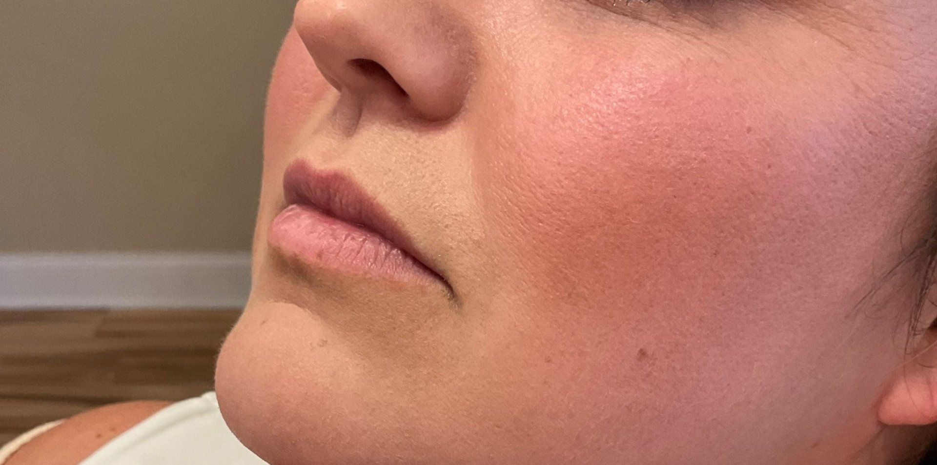 Lips