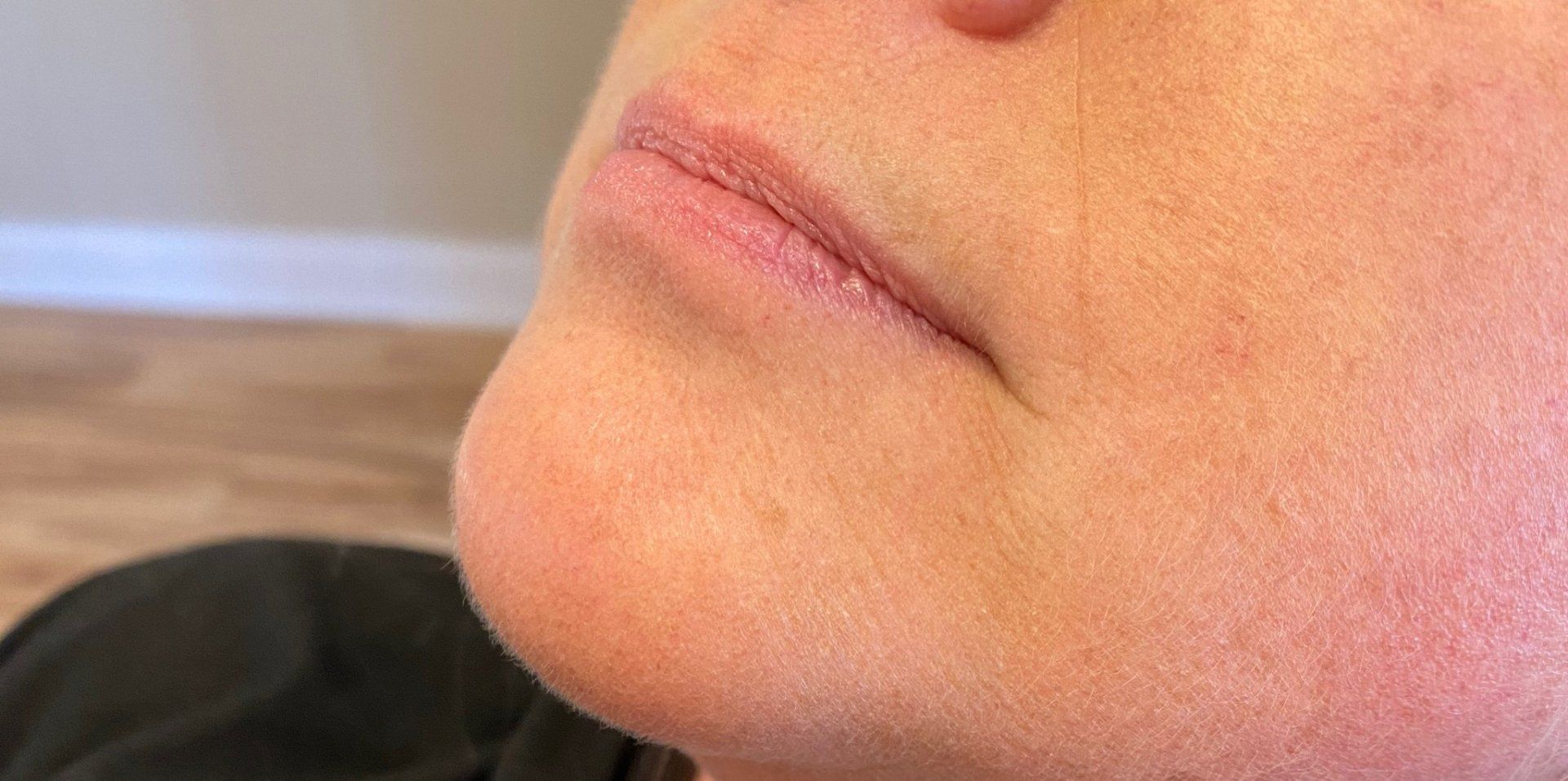 Lips