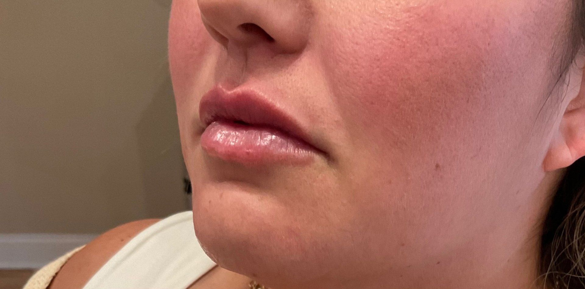 Lips