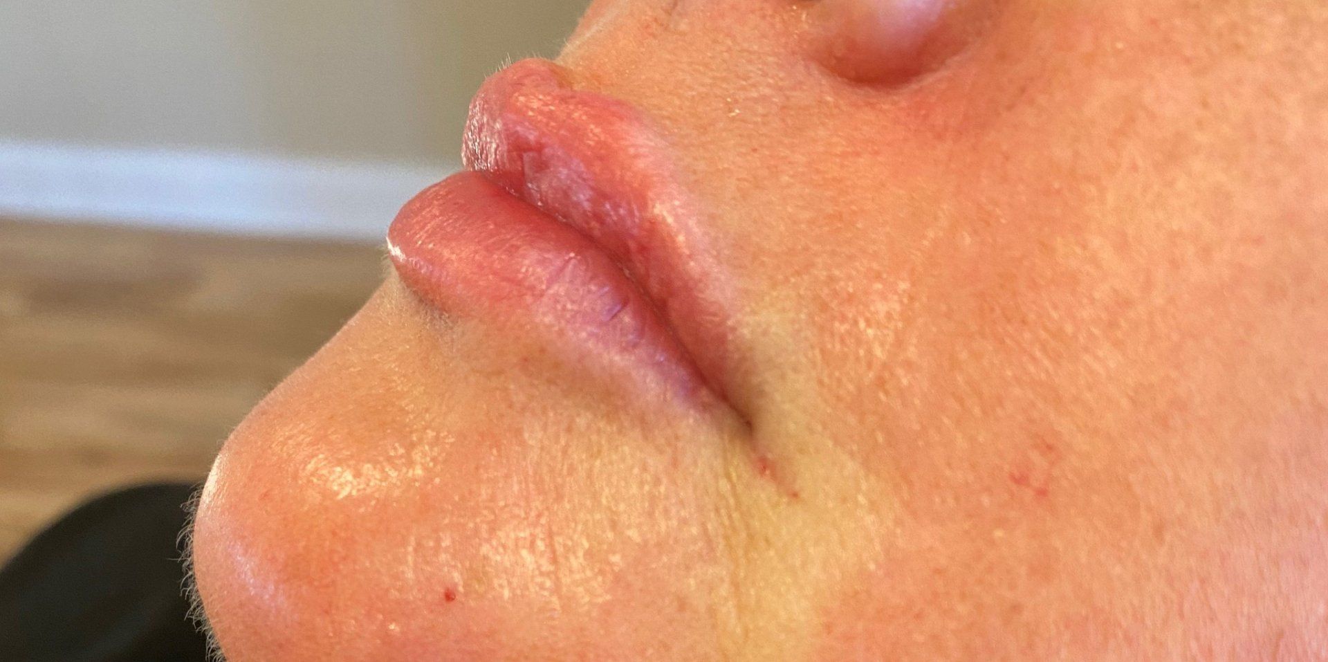 Lips