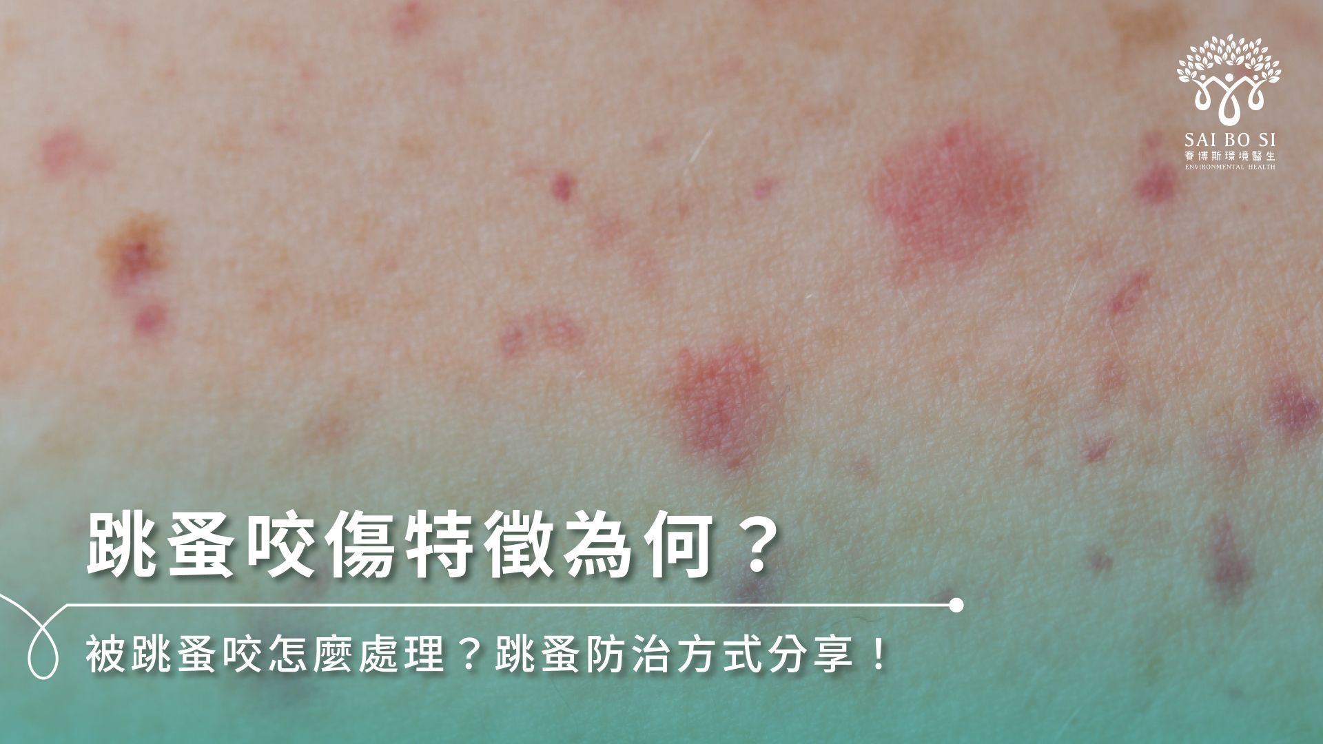 跳蚤咬傷特徵為何?被跳蚤咬怎麼處理?跳蚤防治方式分享!