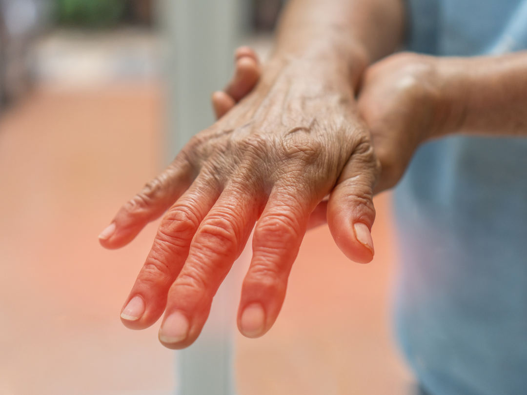 A woman is holding her hand in pain because of arthritis.