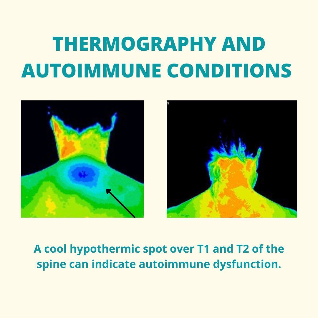 Thermal imaging