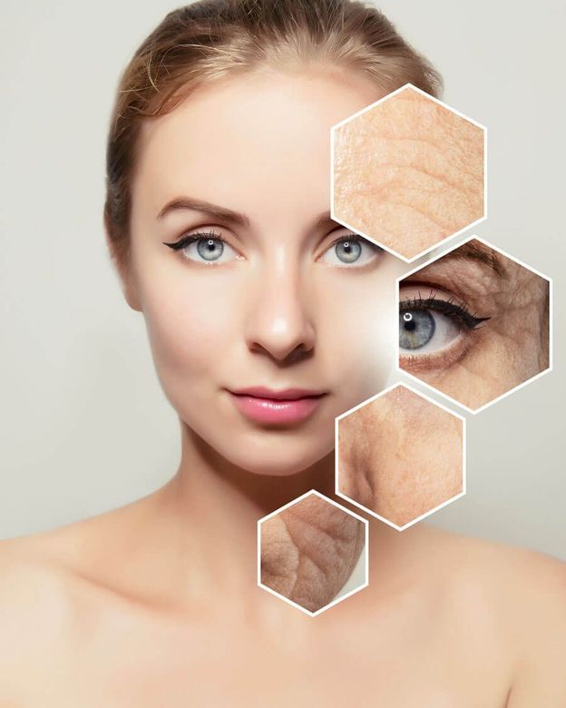 microdermabrasion woman