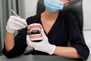 Carillas dentales