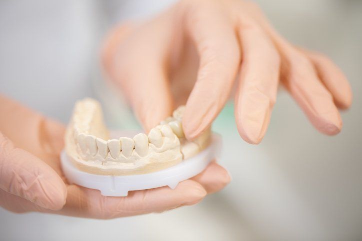 dental crown