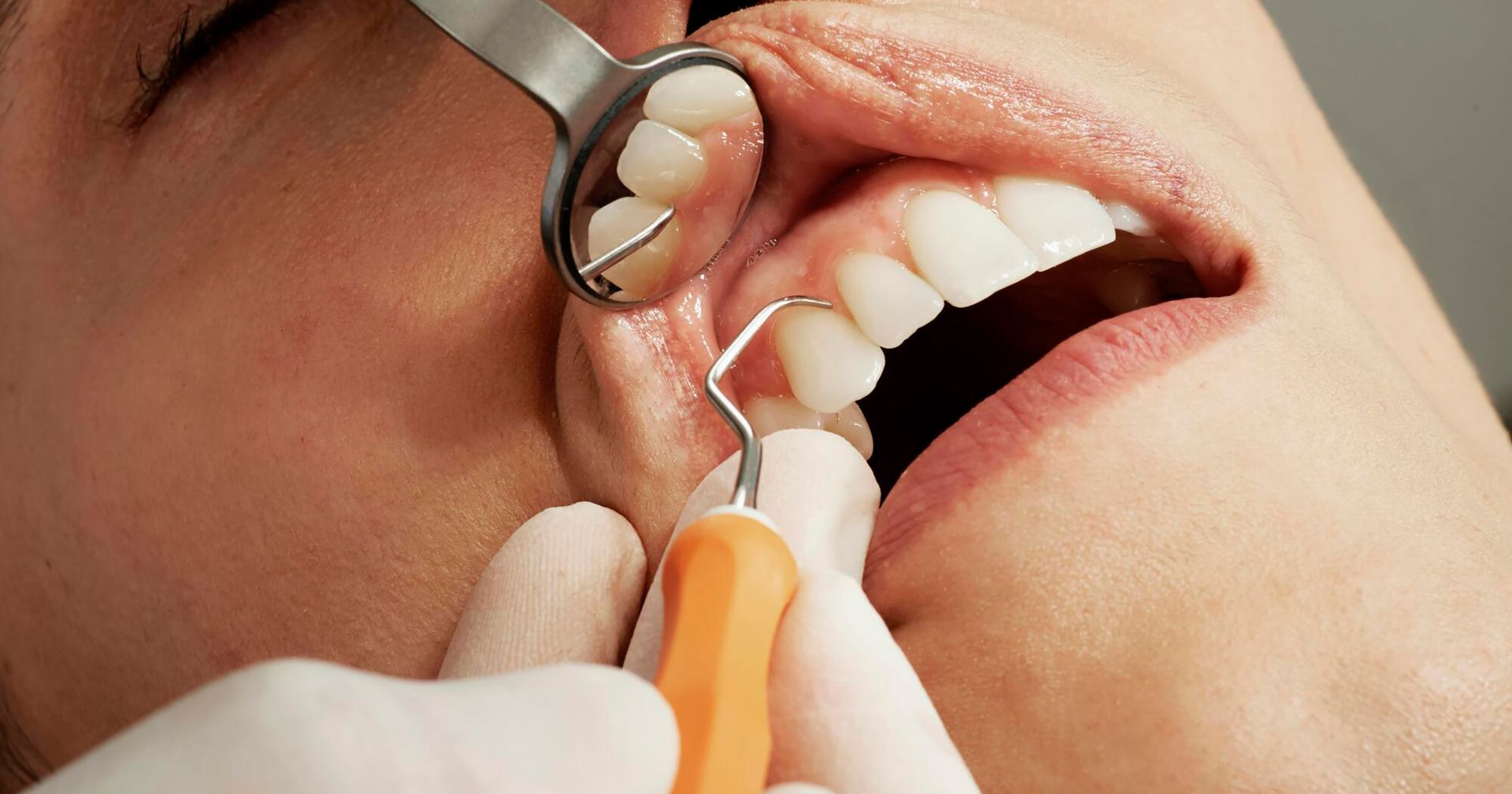 gum disease