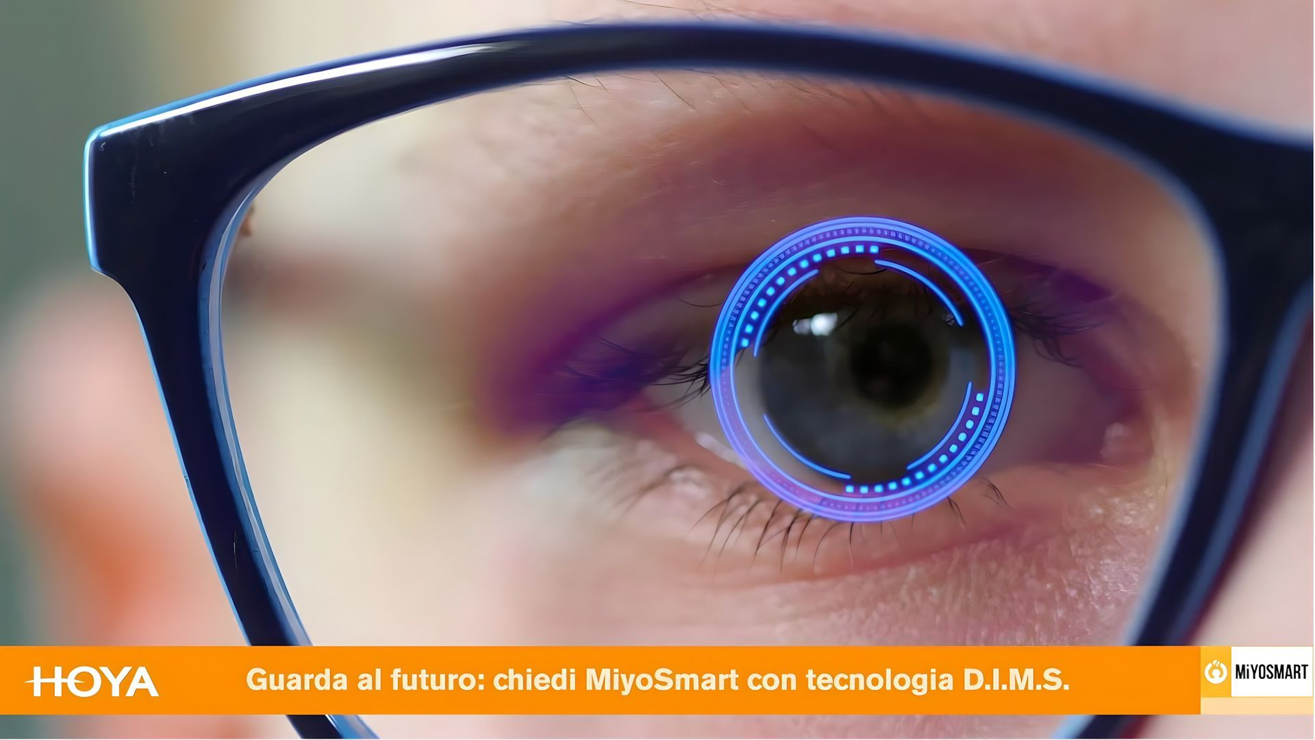 Hoya MiYOSMART le lenti che rallentano la miopia da Ottica Lente Amica a rimini 0541 787275