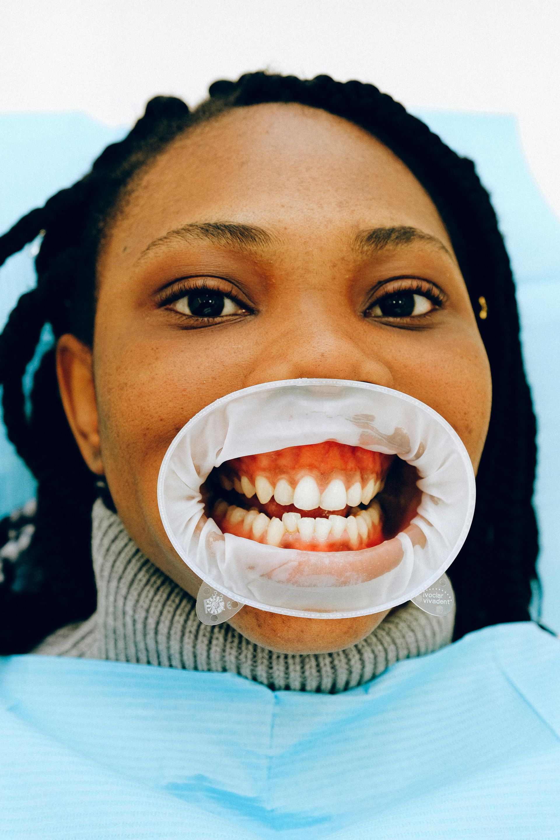 Woman at dentist, mouth open with retractor, revealing teeth. Blue dental sheet, indoor setting.