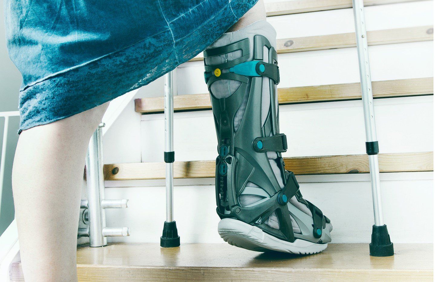 Fractures — Acacia Podiatry in Parap, NT Fractures — Acacia Podiatry in Parap, NT