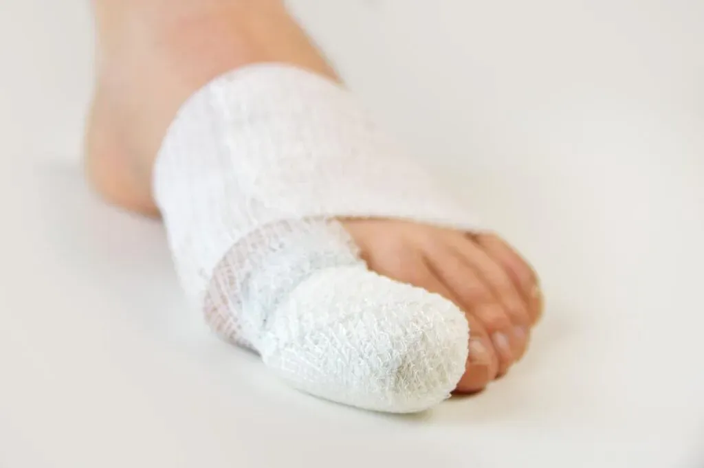 Turf Toe — Acacia Podiatry in Parap, NT Turf Toe — Acacia Podiatry in Parap, NT