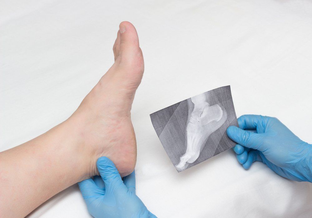 Ankle Pain — Acacia Podiatry in Parap, NT Ankle Pain — Acacia Podiatry in Parap, NT