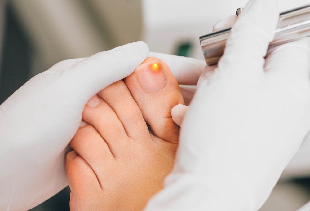 Ingrown Toenail Treatment — Acacia Podiatry in Parap, NT Ingrown Toenail Treatment — Acacia Podiatry in Parap, NT