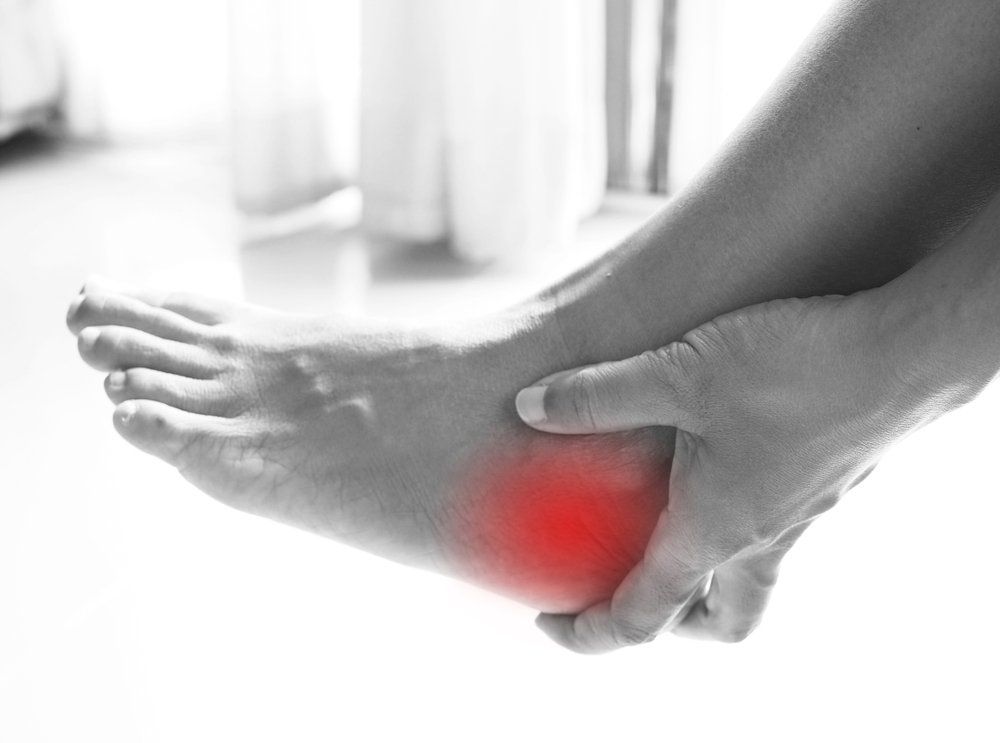 Heel Spurs — Acacia Podiatry in Parap, NT Heel Spurs — Acacia Podiatry in Parap, NT