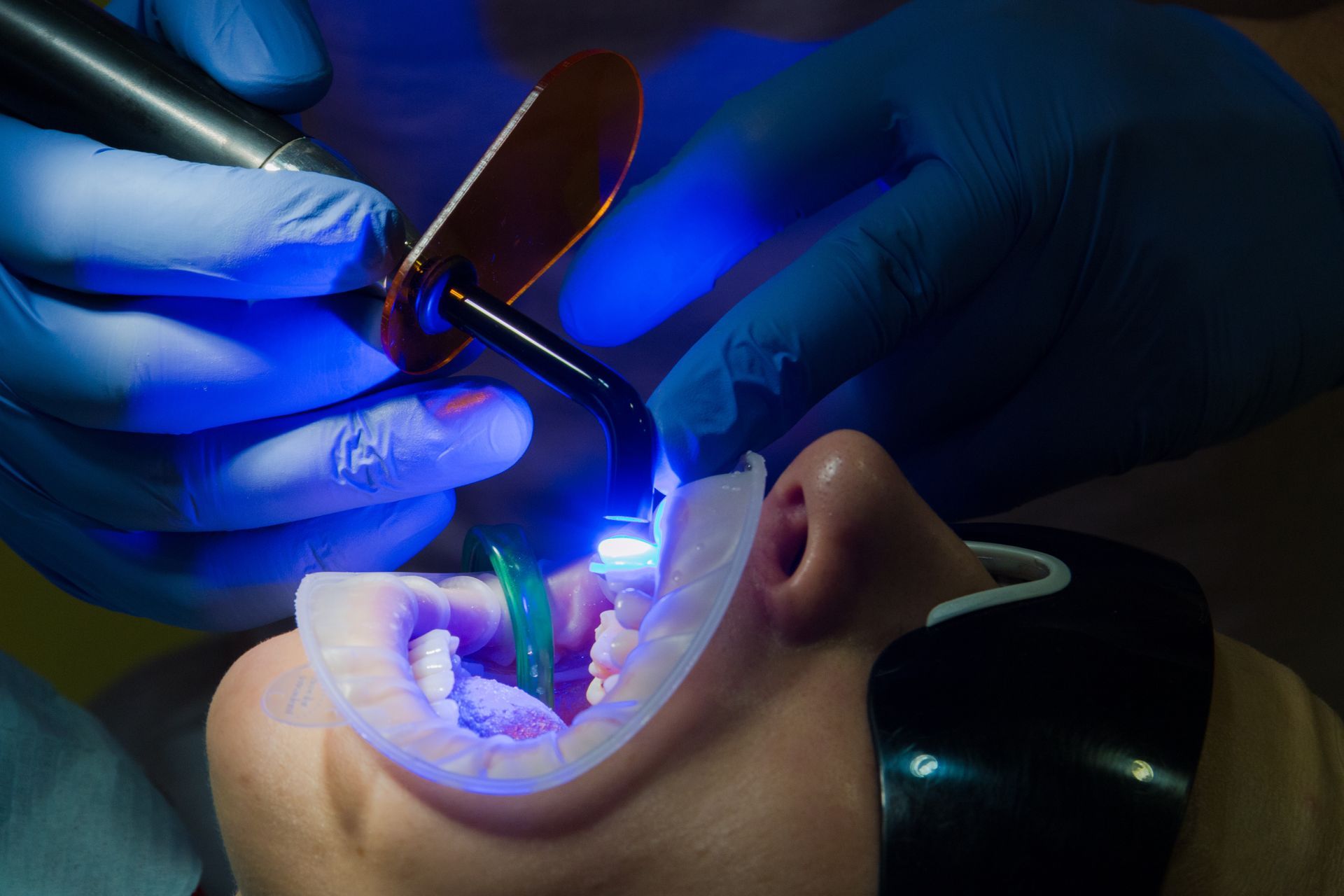 estetica dentale