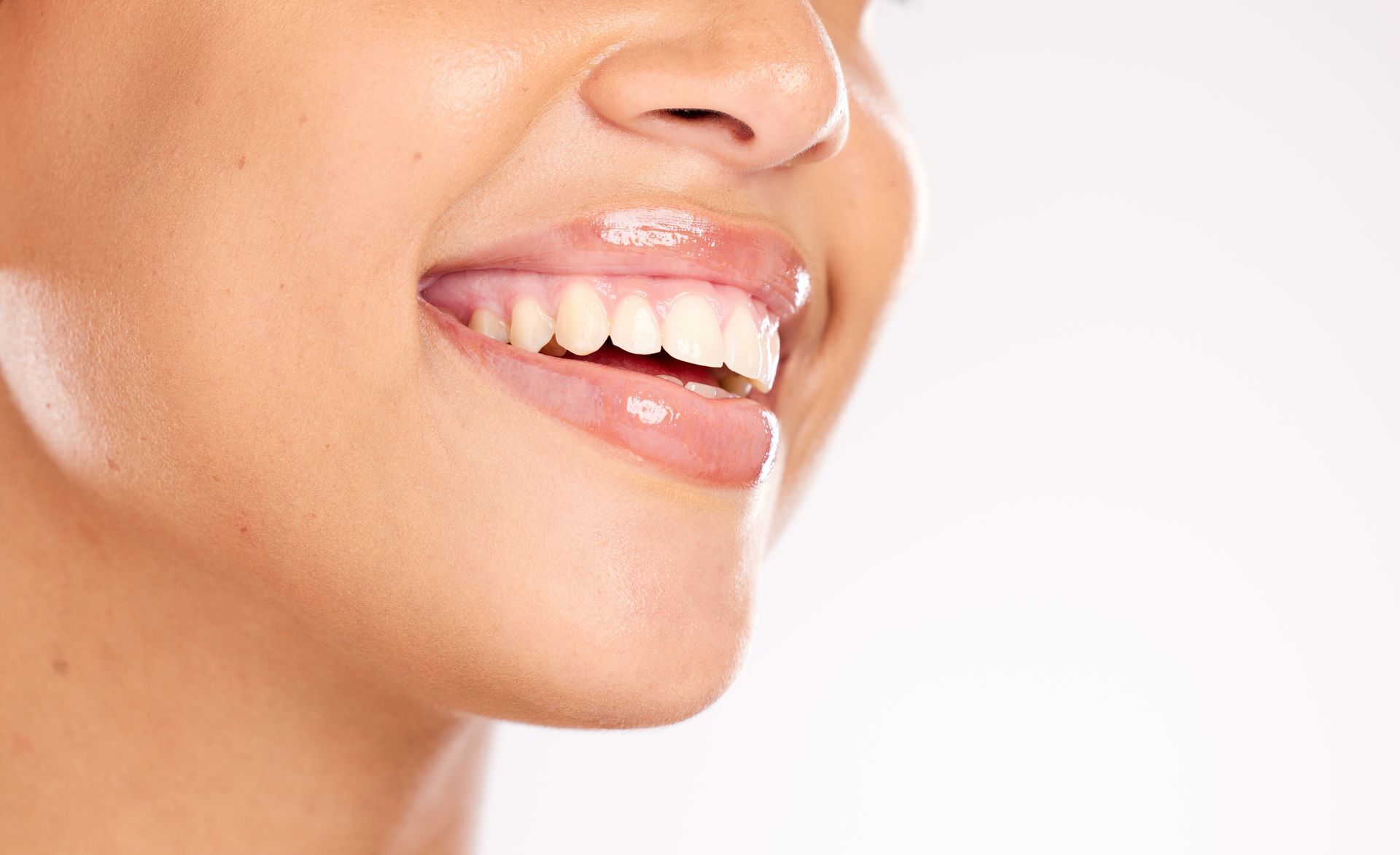 Close-up of a smiling mouth with glossy lips showing white teeth against a white background