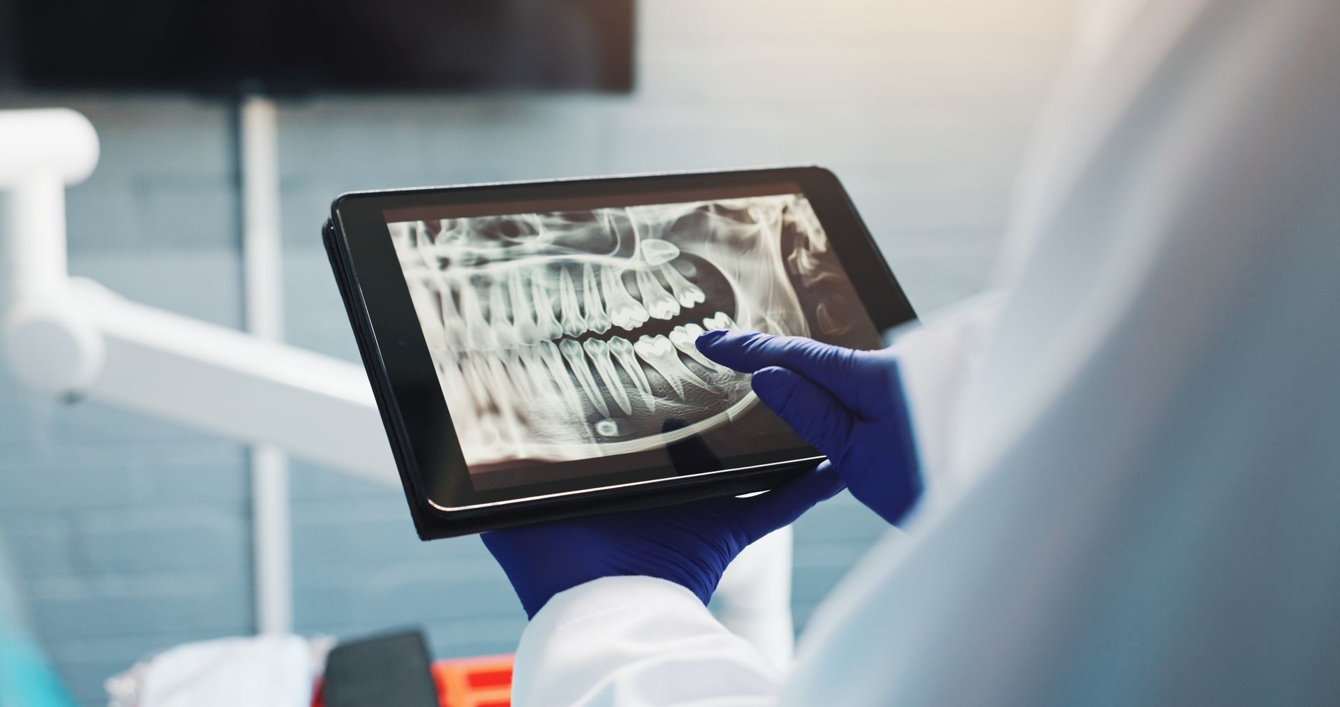 Gloved hands holding a tablet displaying a dental X-ray in a clinic setting