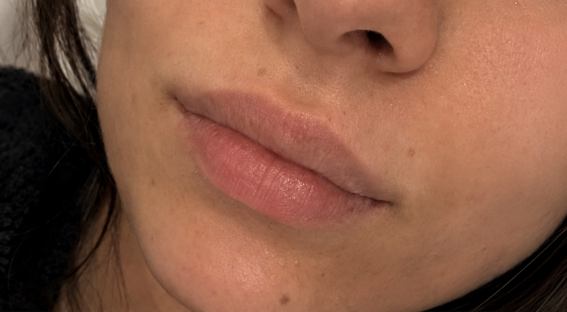 Primo piano della parte inferiore del viso di una persona con labbra neutre e carnagione chiara su sfondo scuro.