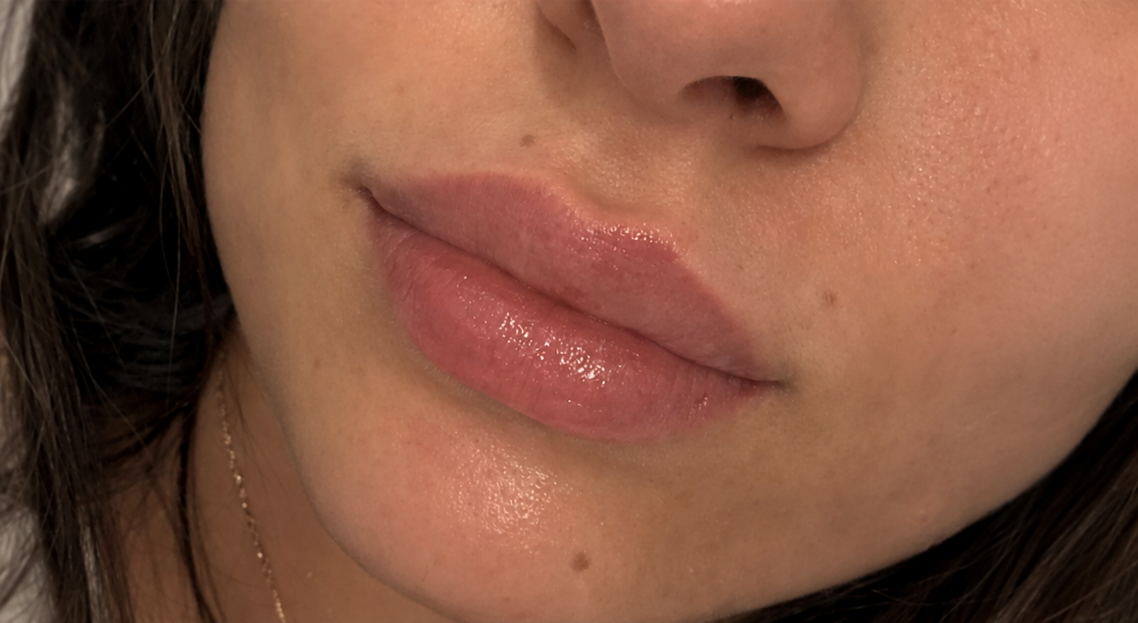 Primo piano di labbra rosa lucide e parte inferiore del viso illuminate da una luce calda.