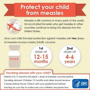 Measles
