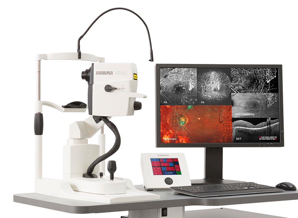 Microscopio medico con monitor che visualizza le scansioni retiniche e un computer portatile su una postazione di lavoro.