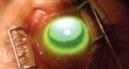 Primo piano di un occhio verde luminoso sotto una palpebra o una lente traslucida
