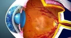 Illustrazione a colori di una sezione trasversale di un occhio umano che mostra il cristallino, la retina e il nervo ottico.