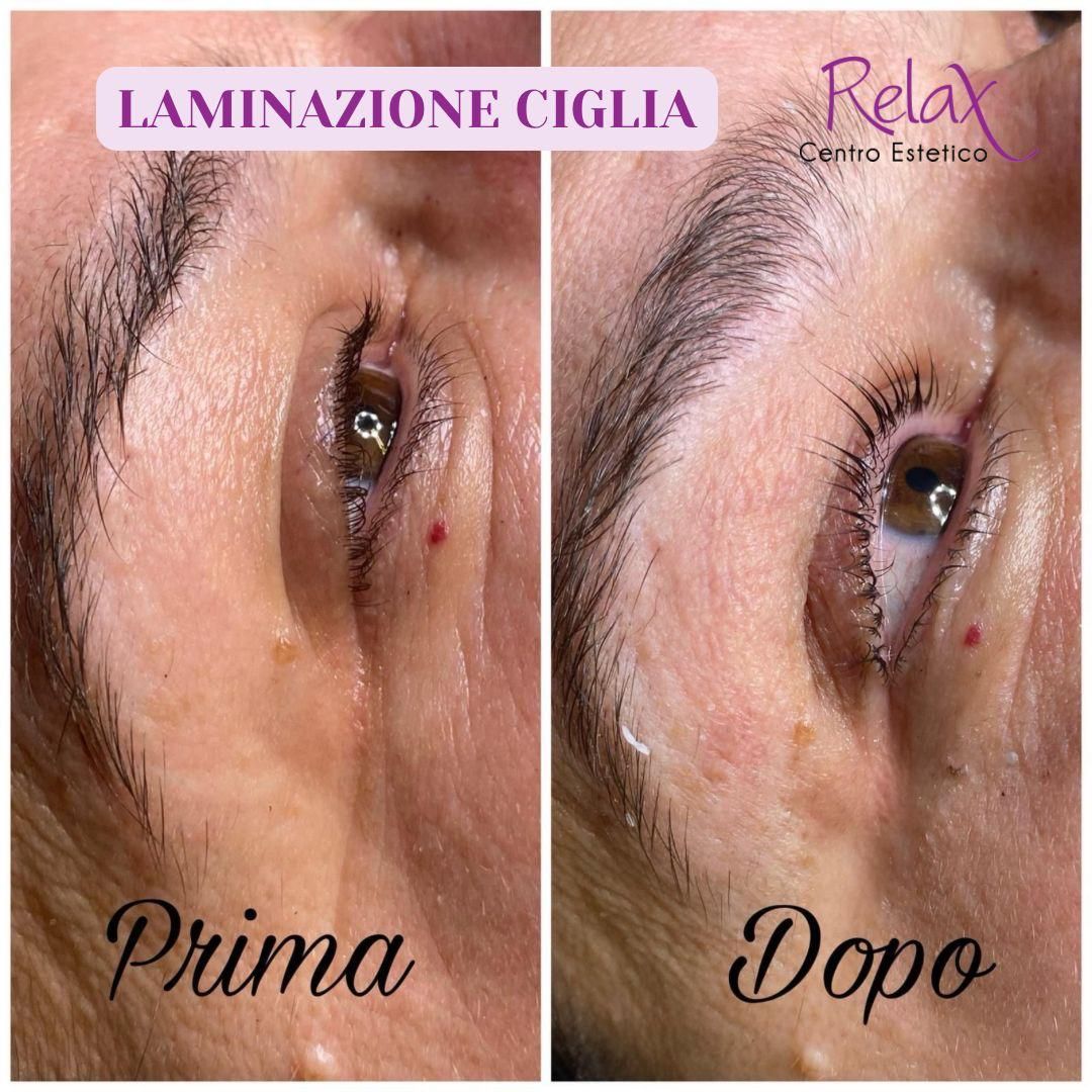 Primo piano prima e dopo di un trattamento di laminazione ciglia, con le denominazioni 