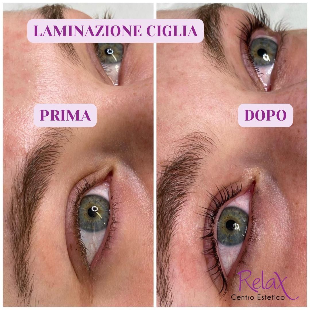 Collage di foto prima e dopo della laminazione delle ciglia, etichettate 