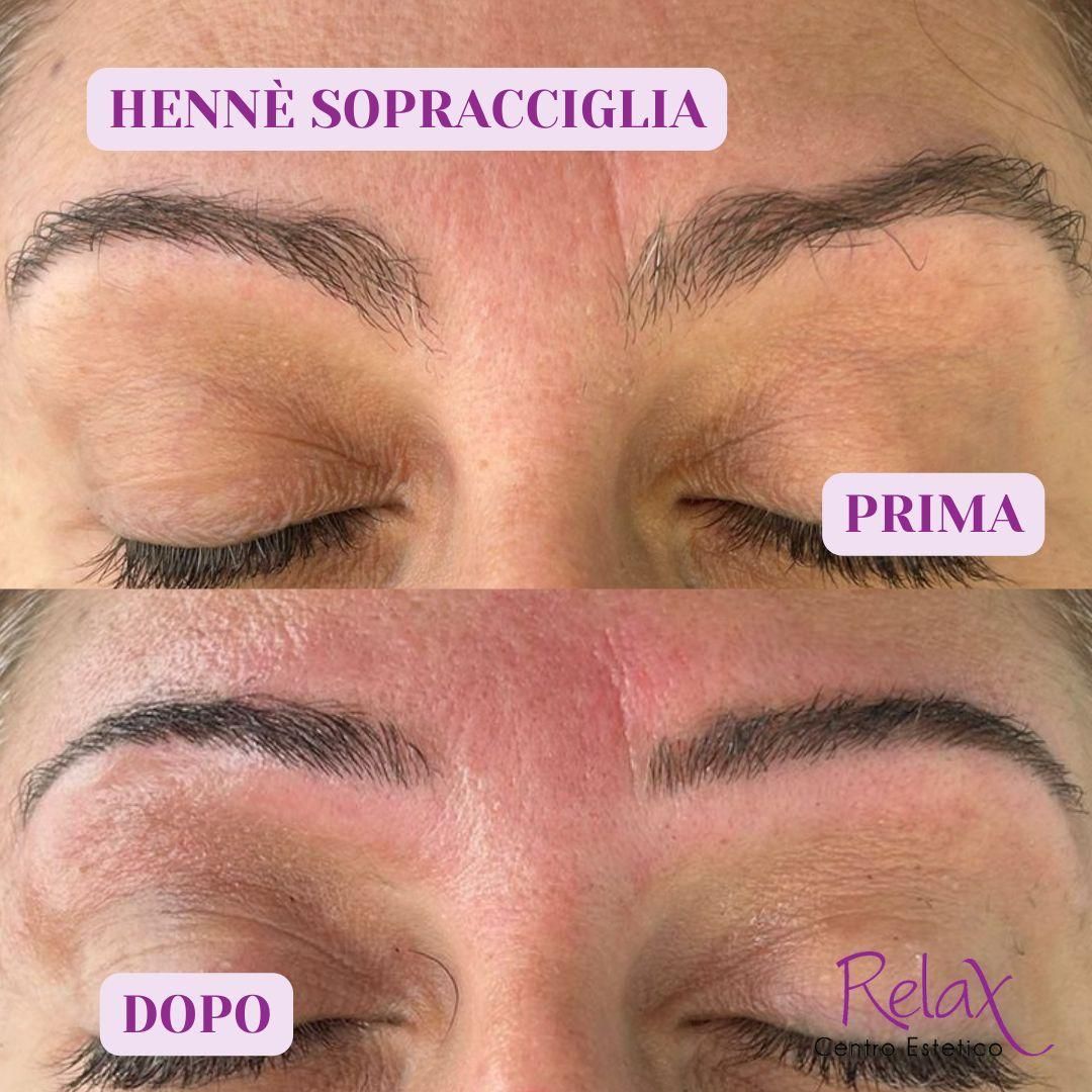 Primo piano delle sopracciglia prima e dopo: sopracciglia superiori prima, sopracciglia inferiori dopo, con le diciture 