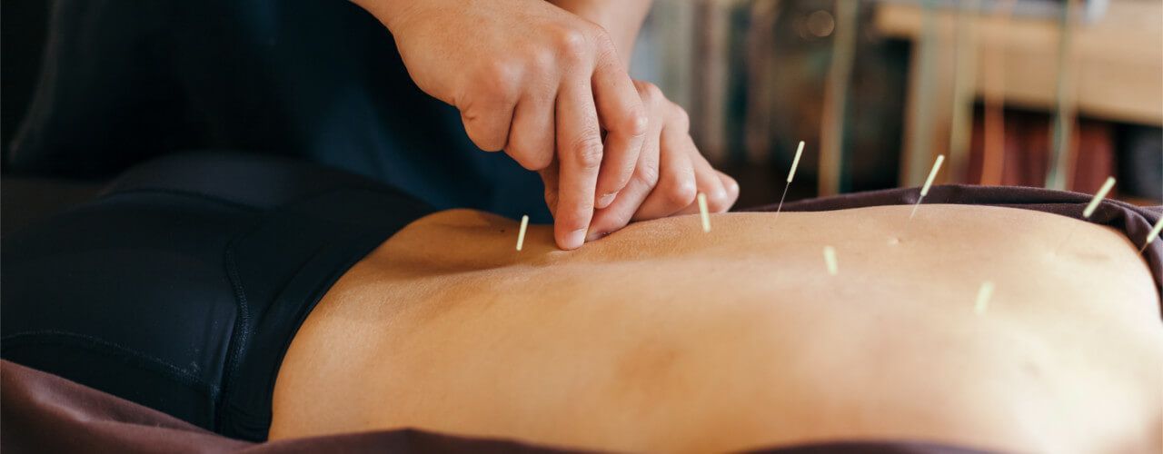 Acupuncture Toronto, ON