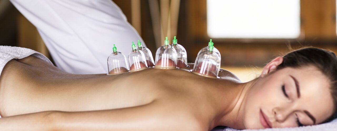 Cupping Toronto, ON