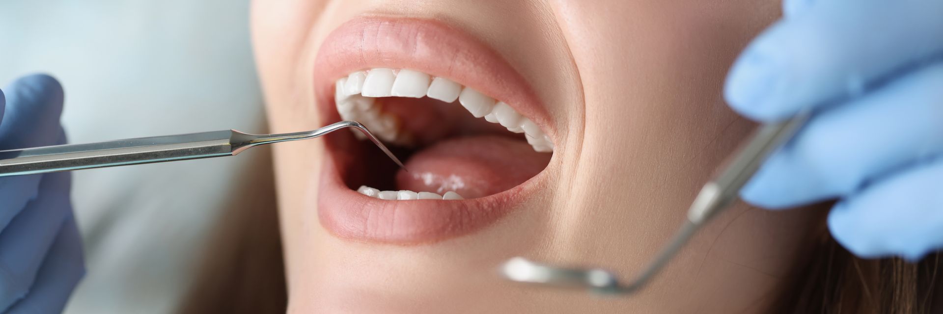 A dentist examines the oral cavity of a female patient