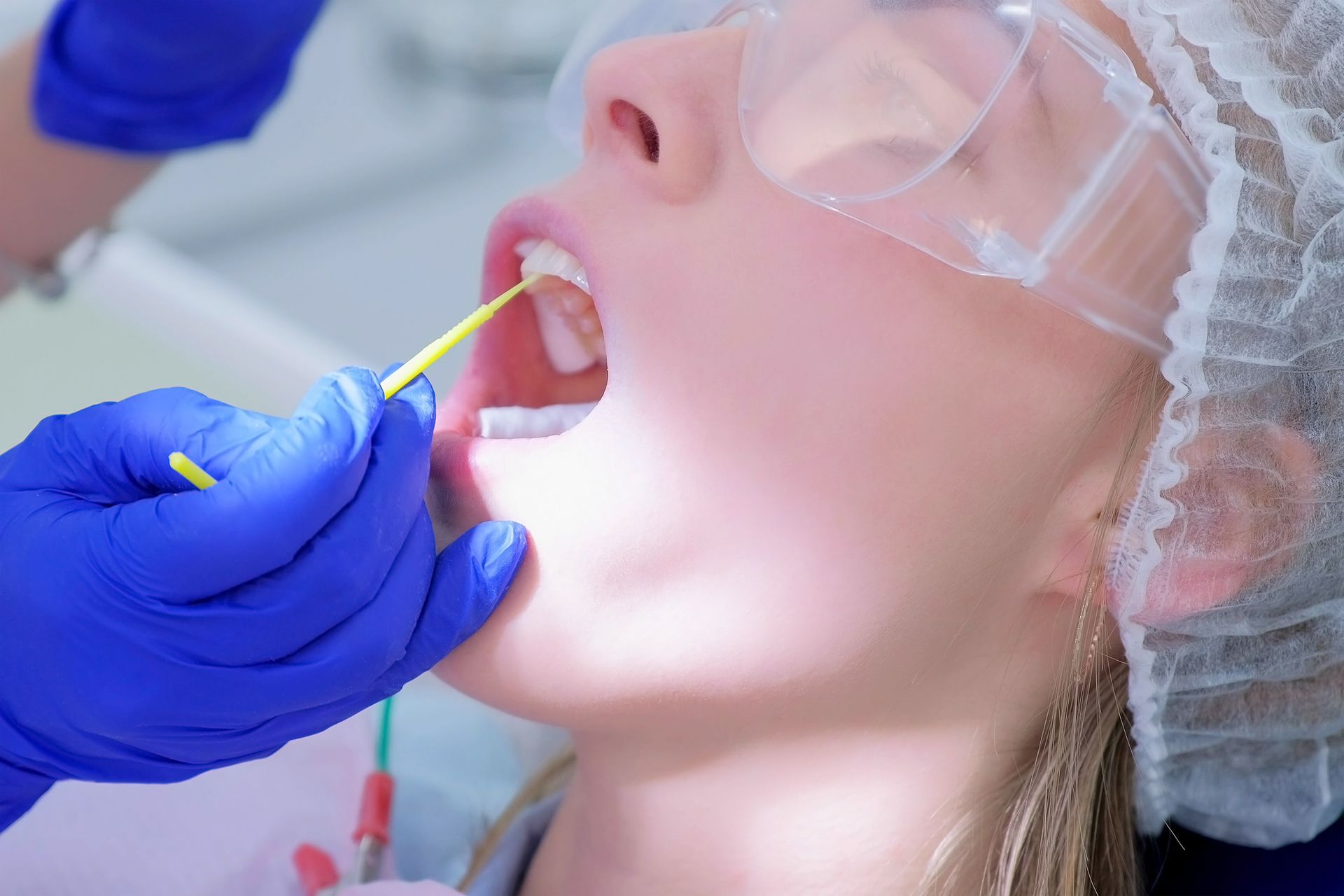 Fluoride Treatments for Added Protection
