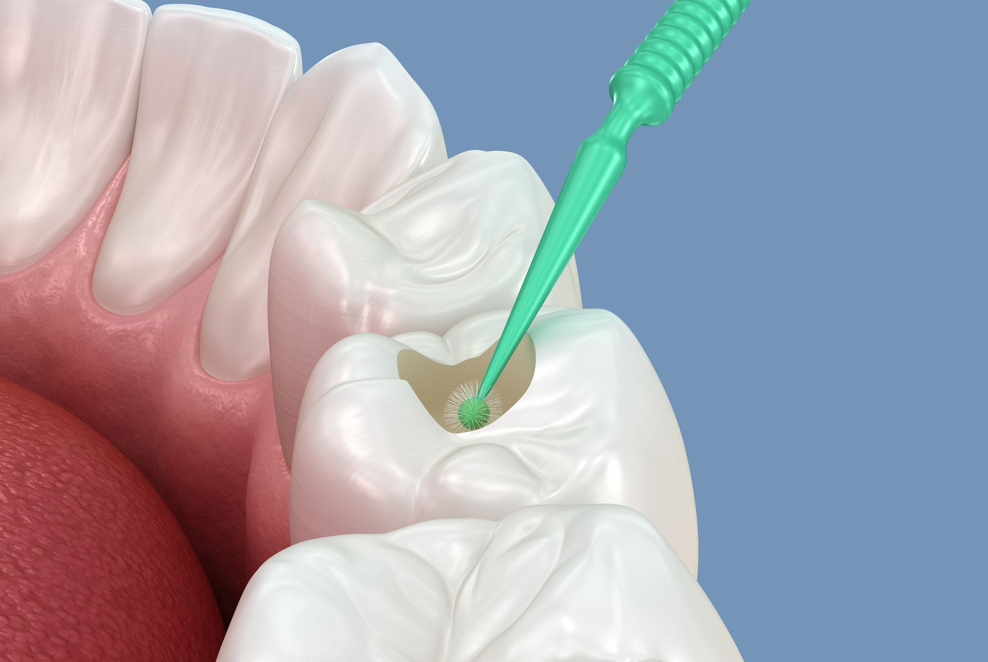 Fillings for Stronger