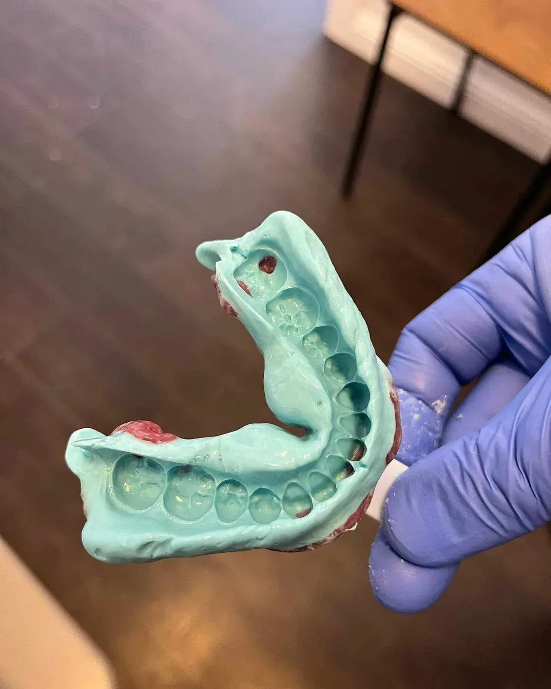 A Person Wearing Blue Gloves is Holding a Dental Impression — Jaw Gear Dental Prosthetics in Mittagong, NSW